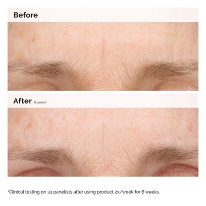 The Ordinary
Retinal 0.2% Emulsion Serum
