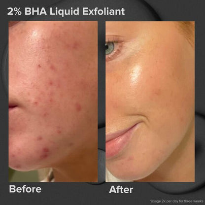 Paula's Choice
Multi-Level Exfoliation Trial Kit
