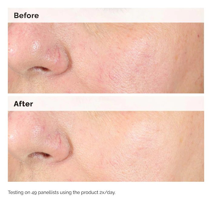The Ordinary Alpha Arbutin 2% + HA Hyperpigmentation Serum