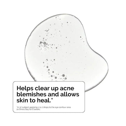 The Ordinary Salicylic Acid 2% Solution for Acne