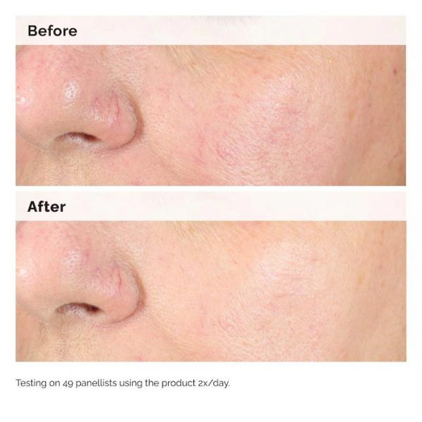The Ordinary Alpha Arbutin 2% + HA Hyperpigmentation Serum