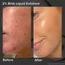 Paula's Choice
Multi-Level Exfoliation Trial Kit