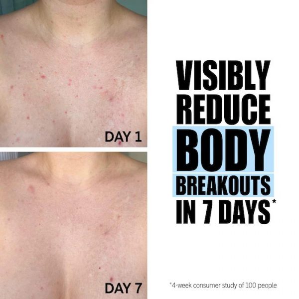 The INKEY List 
Glycolic Acid Exfoliating Body Stick