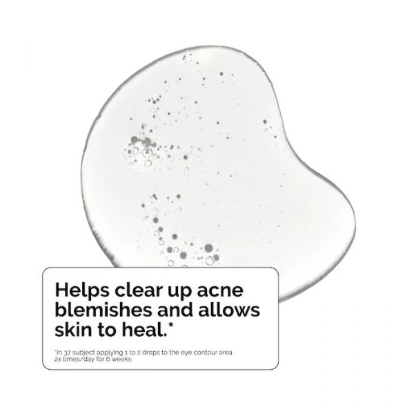 The Ordinary Salicylic Acid 2% Solution for Acne